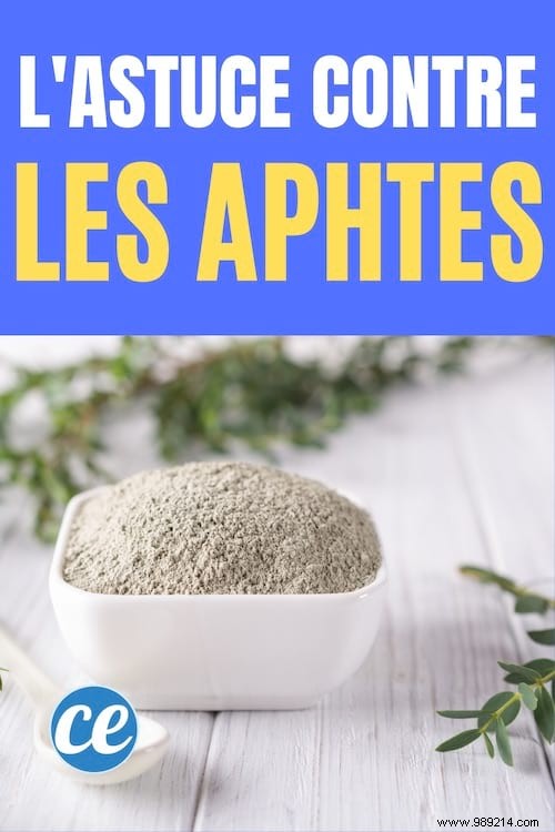 Pharmacist-Approved Green Clay Remedy for Fast Canker Sore Relief