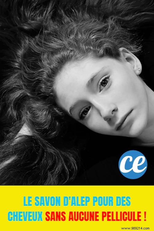 How Aleppo Soap Banishes Dandruff: My Proven Natural Routine