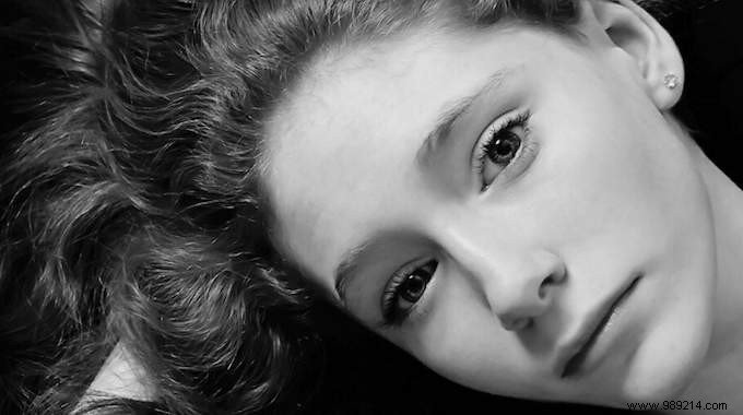 How Aleppo Soap Banishes Dandruff: My Proven Natural Routine