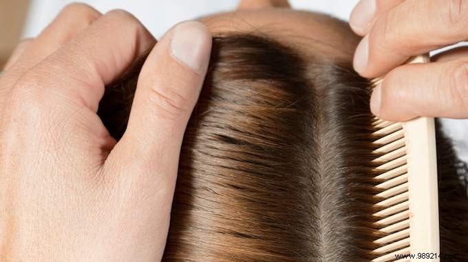 Conceal Fast-Growing Roots with a Zig-Zag Part: My Go-To Trick for California Blonde