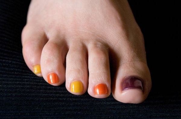 5 Easy DIY Pedicure Ideas for Stunning Summer Feet