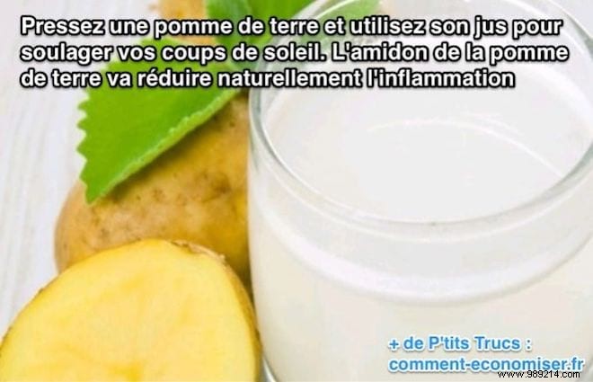 Quick Sunburn Relief: Potato Slices as a Natural Anti-Inflammatory Remedy