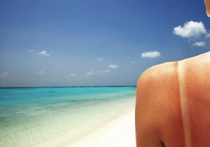 Yogurt: A Proven Natural Remedy for Soothing Sunburn Pain and Redness