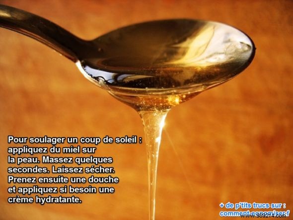 Soothe Sunburn Naturally: Why Honey is Your Go-To Home Remedy