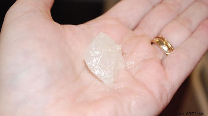 How to Soothe a Mild Burn with Vaseline: Proven Steps for Fast Relief