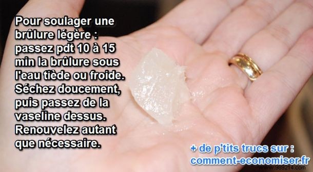 How to Soothe a Mild Burn with Vaseline: Proven Steps for Fast Relief