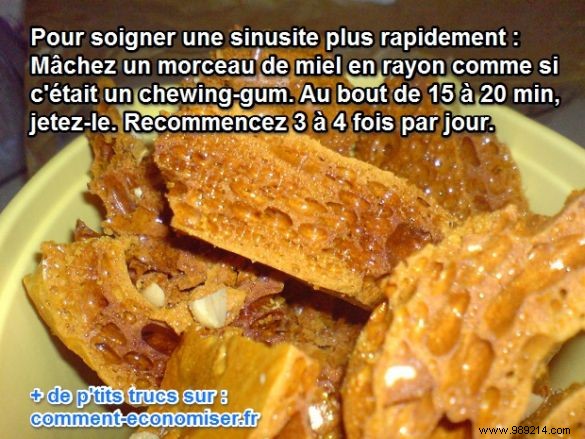 Chew Comb Honey for Faster Sinusitis Relief: A Natural Boost to Healing