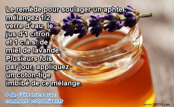 2 Proven Natural Remedies to Relieve Painful Canker Sores