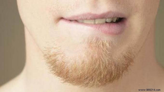 2 Proven Natural Remedies to Relieve Painful Canker Sores