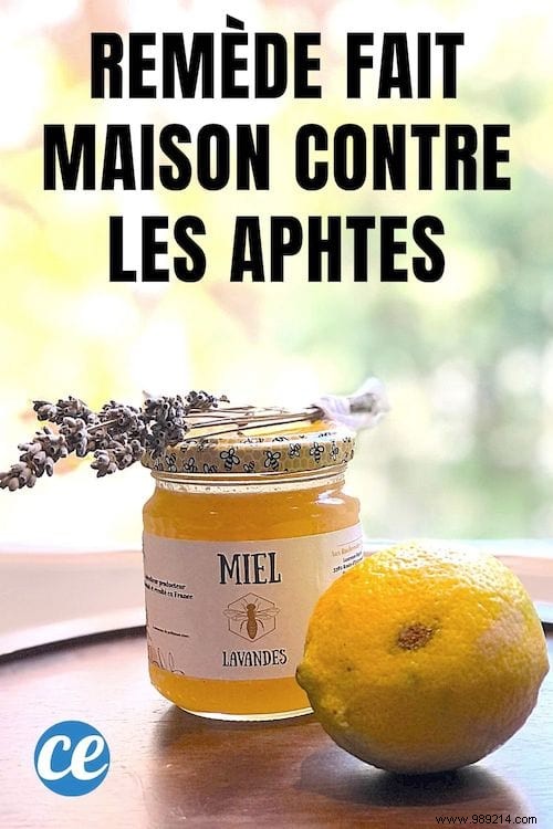 2 Proven Natural Remedies to Relieve Painful Canker Sores