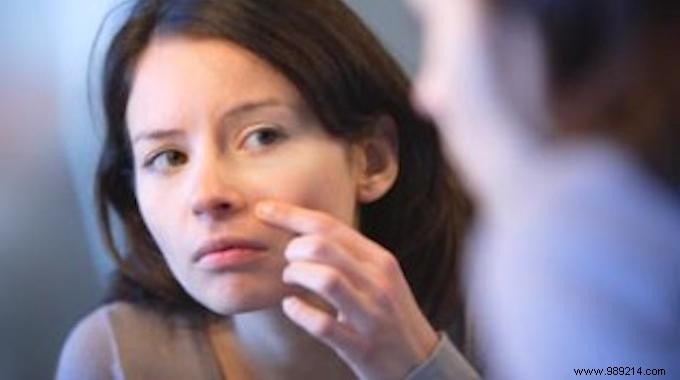 Quickly Shrink a Pimple in Minutes Using Listerine: A Simple Home Remedy