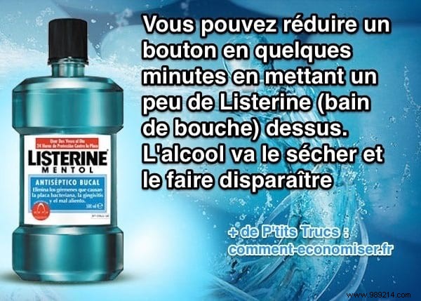 Quickly Shrink a Pimple in Minutes Using Listerine: A Simple Home Remedy