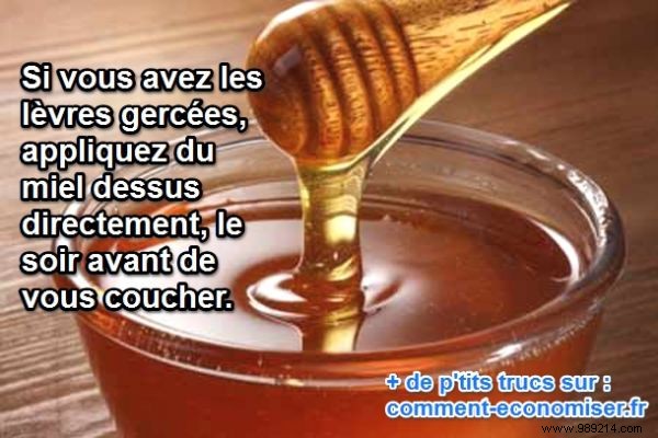 Heal Chapped Lips and Skin Naturally with Honey: A Proven Gentle Remedy