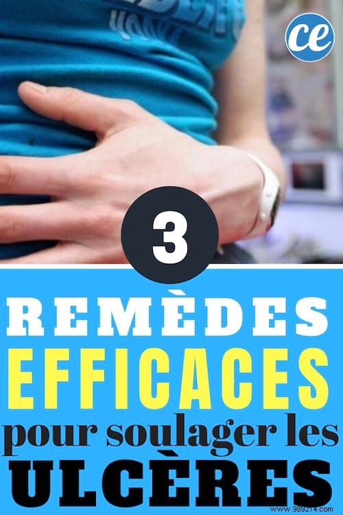 3 Proven Natural Remedies to Effectively Relieve Stomach Ulcers