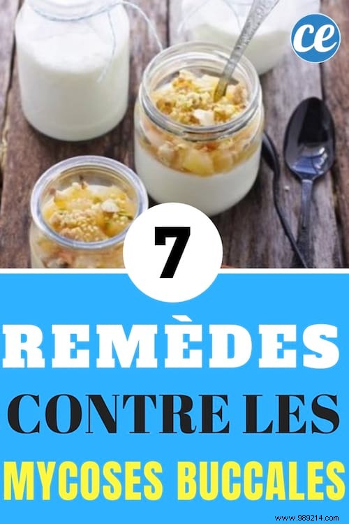 7 Effective Home Remedies for Oral Thrush: My Tried-and-Tested Natural Relief