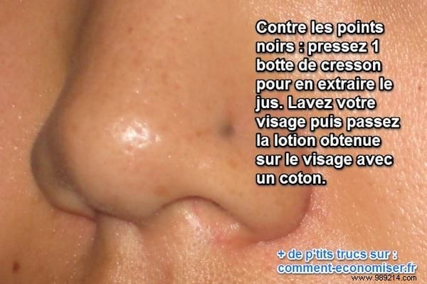 Natural Watercress Remedy: A Simple Way to Combat Blackheads