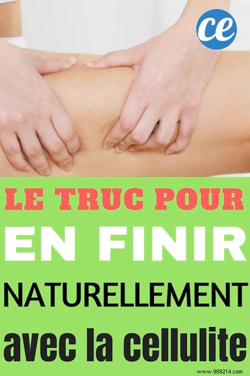 Proven Natural Ways to Reduce Cellulite: Simple, Effective Strategies