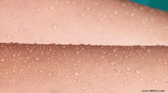 How to Naturally Moisturize Dry Skin with Sweet Almond Oil