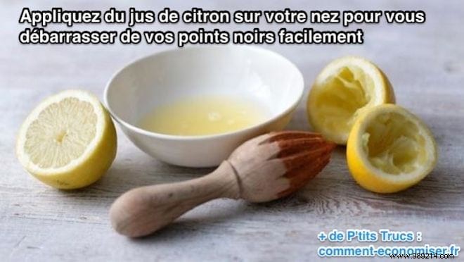 Lemon Juice: A Natural, Effective Remedy for Blackhead Removal