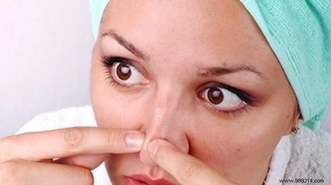 Lemon Juice: A Natural, Effective Remedy for Blackhead Removal