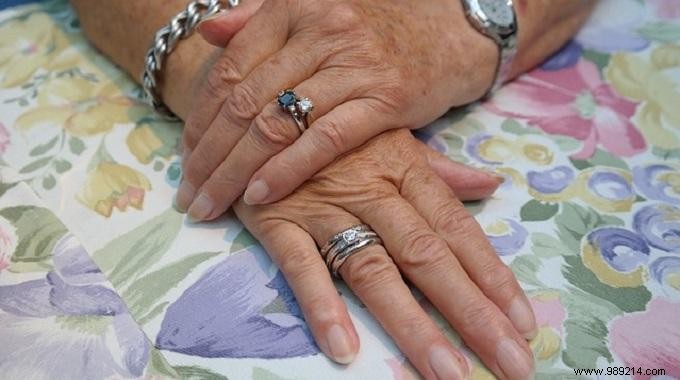 Repair Brittle Nails Naturally: The Simple Petroleum Jelly Remedy