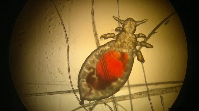 Beat Head Lice Naturally: My Proven Olive Oil and Lavender Recipe