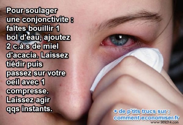 Effective Natural Honey Remedy for Conjunctivitis Relief