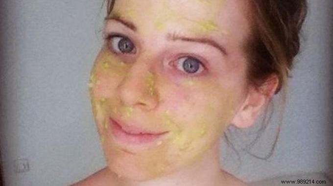 Revive Dry Skin Naturally: Proven Avocado Mask Recipe