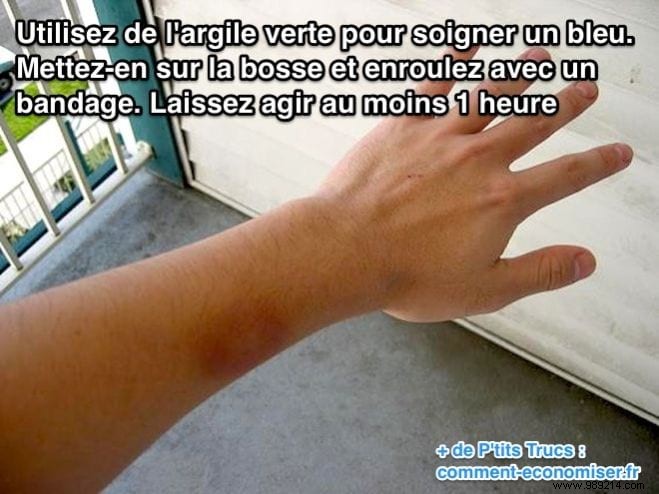 Heal Bruises and Bumps Quickly with Green Clay: A Pharmacist-Recommended Home Remedy