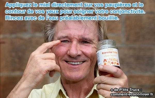 How Honey Can Naturally Soothe Conjunctivitis Symptoms: A Trusted Home Remedy