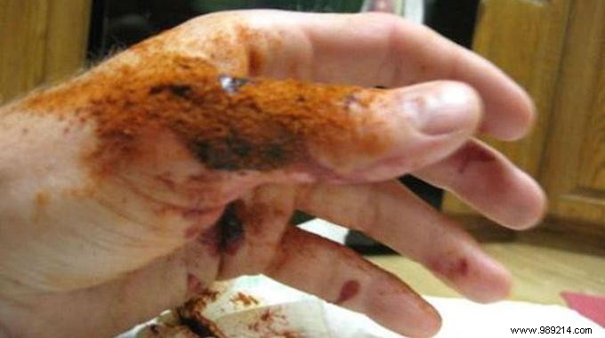 Stop Bleeding from Minor Cuts Fast: The Black Pepper Trick That Actually Works
