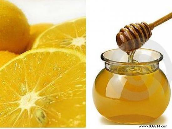 7 Proven Natural Remedies to Relieve Hangover Symptoms Fast