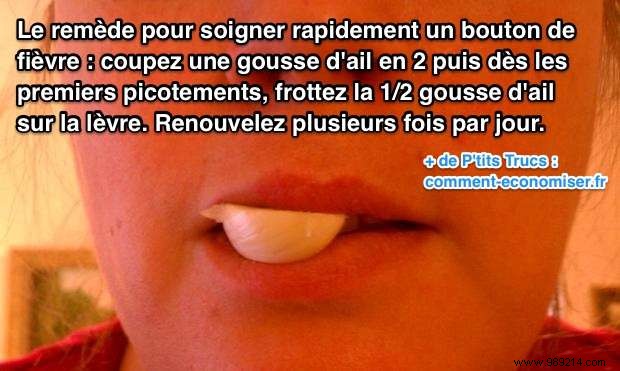 Effective Garlic Remedy: Banish Cold Sores on Lips in Days