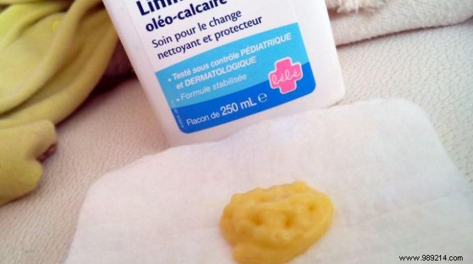 Natural Remedy for Sore, Cracked Nipples from Breastfeeding: Oleo-Calcareous Liniment