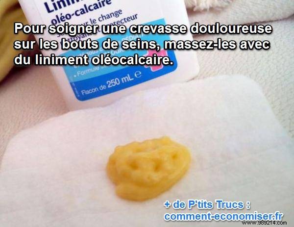 Natural Remedy for Sore, Cracked Nipples from Breastfeeding: Oleo-Calcareous Liniment