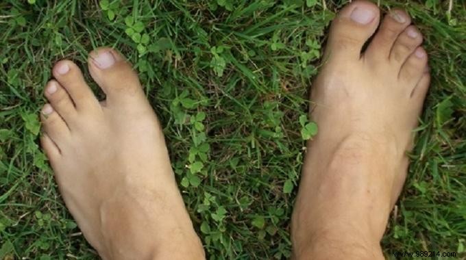 Heal Dry, Cracked Heels Naturally: Proven Olive Oil Remedy