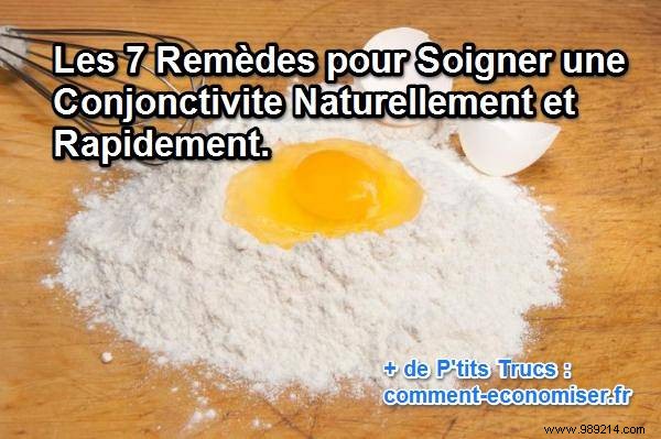 7 Proven Natural Remedies for Quick Conjunctivitis Relief at Home