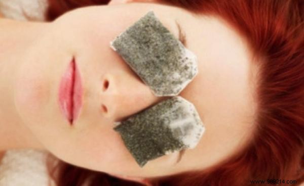 7 Proven Natural Remedies for Quick Conjunctivitis Relief at Home