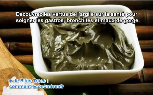 3 Proven Clay Poultice Remedies for Winter Ailments Like Sore Throat and Bronchitis