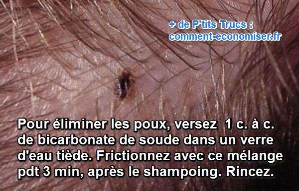 Natural Baking Soda Remedy: Eliminate Head Lice Effectively and Safely