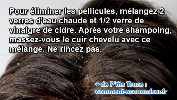 Eliminate Dandruff Naturally: Proven Apple Cider Vinegar Hair Rinse Recipe