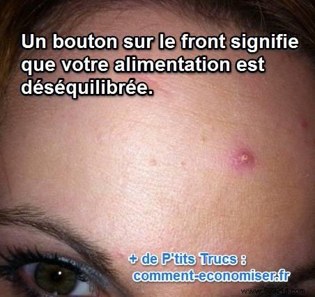 What the Location of Your Pimples Reveals About Your Health