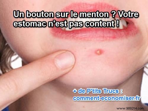 What the Location of Your Pimples Reveals About Your Health