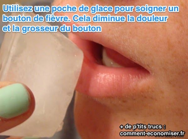 9 Proven Natural Home Remedies to Heal Cold Sores Fast