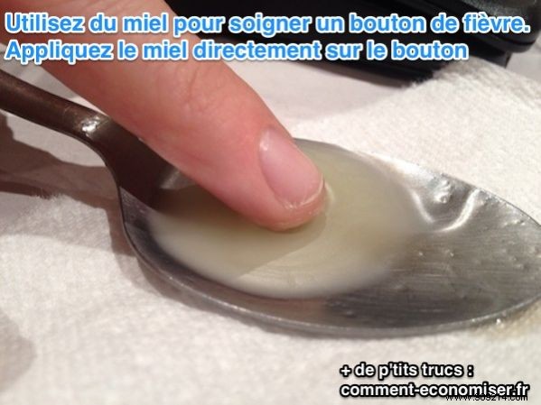 9 Proven Natural Home Remedies to Heal Cold Sores Fast