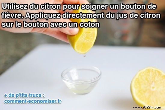 9 Proven Natural Home Remedies to Heal Cold Sores Fast