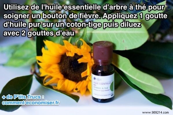 9 Proven Natural Home Remedies to Heal Cold Sores Fast