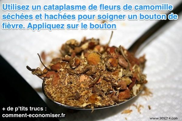 9 Proven Natural Home Remedies to Heal Cold Sores Fast