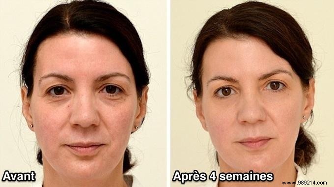 How Drinking 3 Liters of Water Daily Helped a 42-Year-Old Woman Look 10 Years Younger in 4 Weeks