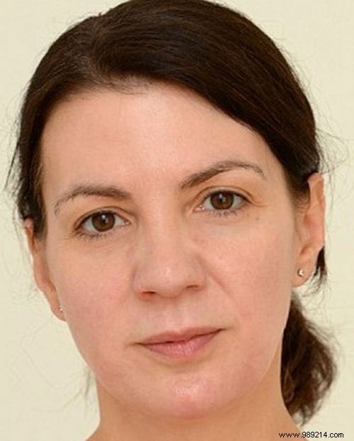 How Drinking 3 Liters of Water Daily Helped a 42-Year-Old Woman Look 10 Years Younger in 4 Weeks